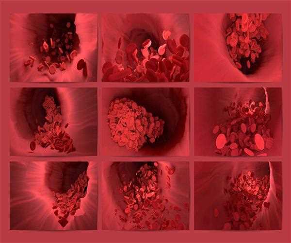 Types of blood clots